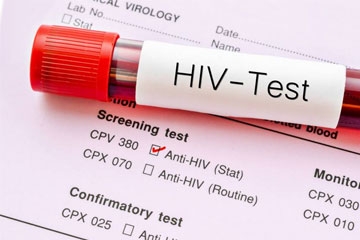 Sağlık Bakanlığı Gebelere HIV Enfeksiyonu Taraması Yapacak